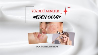 YÜZDEKİ AKNELER NEDEN OLUR?